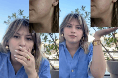 “Marine (Star Academy) dans un état choquant : ‘Gonflée, je suis rouge…’ La candidate victime d’une réaction allergique incroyable, un moment inédit qui secoue le monde de la musique !”