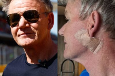 Gordon Ramsay balafré : impressionnante cicatrice sous l’oreille, le chef opéré d’un cancer de la peau