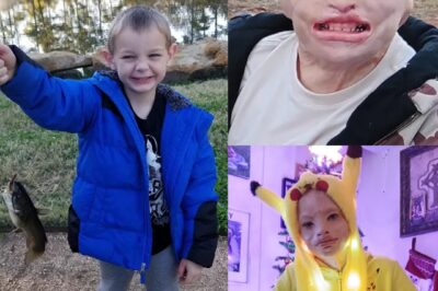 Survivre aux flammes : comment un garçon de 12 ans a retrouvé le chemin de la joie.